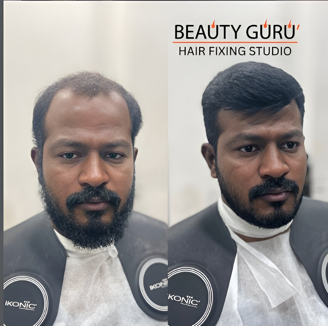 Hair Transformation